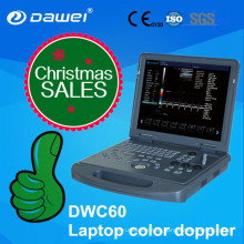 Farb-Doppler-Echokardiographie-Maschine und Farb-Doppler-Ultraschall
